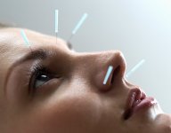 Что такое рефлексотерапия?